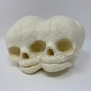 May include: A white plaster model of a conjoined twin skull. The skull has two sets of eye sockets, noses, and mouths.