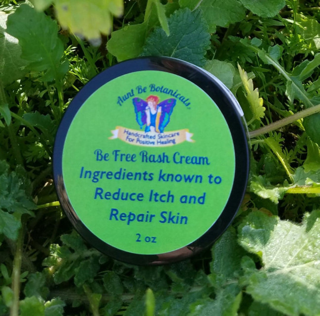 Be Free Body Cream Rash Cream Eczema Cream Eczema Lotion Etsy