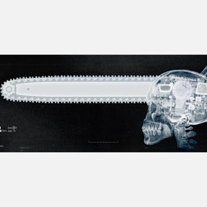 Könnte beinhalten: Ein Schwarzweiß-Röntgenbild eines menschlichen Schädels mit einer Kettensägenklinge, die durch den oberen Teil des Kopfes verläuft. Die Kettensägenklinge ist im Schädel sichtbar, und das Bild ist vor einem schwarzen Hintergrund.