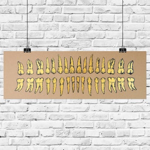 Gold Teeth 5x15in Screen Print
