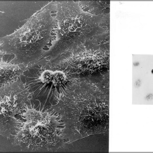 Op de afbeelding: Een zwart-wit microscopische afbeelding van cellen. De cellen zijn geclusterd en hebben een stekelig, stervormig uiterlijk.