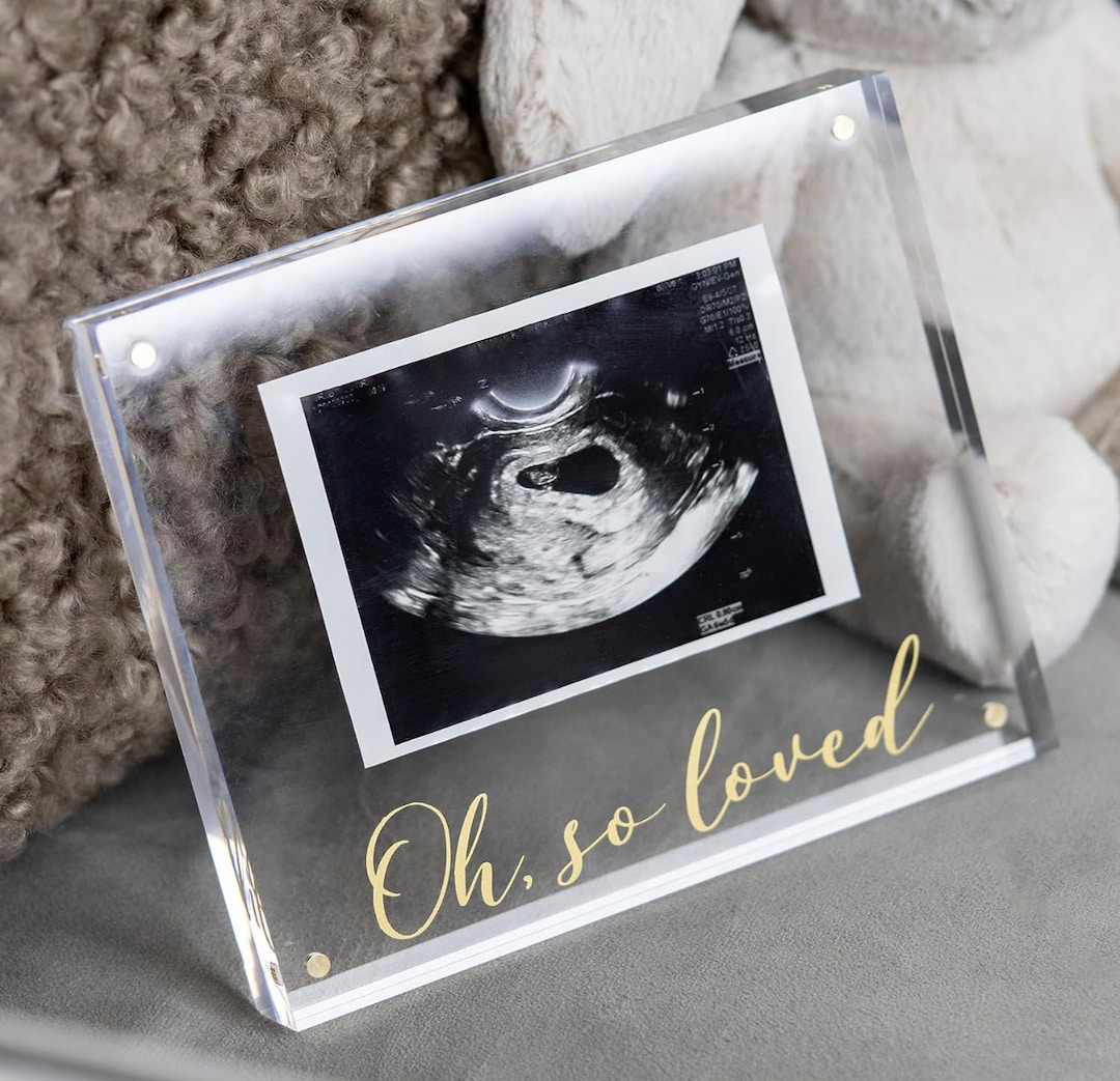 Highend Ultrasound Picture Frames Acrylic & Gold Newborn Photo Sonogram Picture Frame