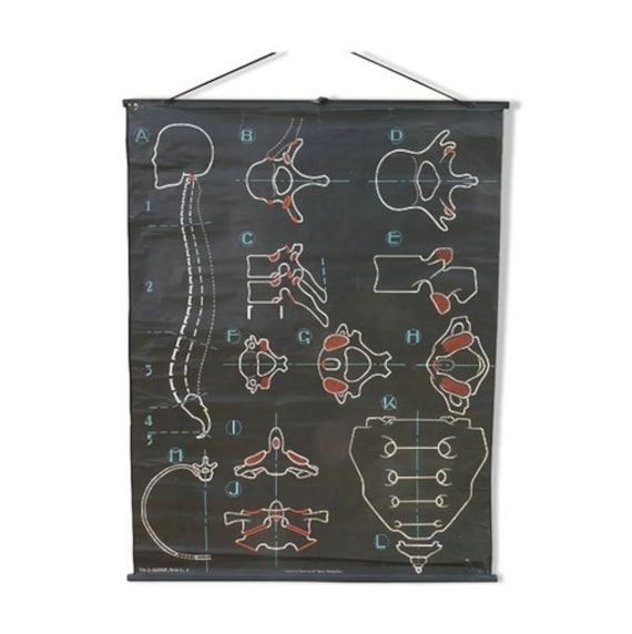 Affiche Scolaire Vintage Dr Auzoux La Colonne Vertébrale/Anatomie Vintage France Années 1950 | Art M