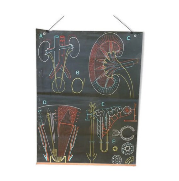Affiche Scolaire Vintage Dr Auzoux S41 - Le Rein N2/Anatomie Vintage France Années 1950 | Art Mural 