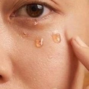 May include: Close-up of a person's eye and face with three drops of a clear, amber-colored liquid applied under the eye. A finger gently touches the skin near the eye. The skin is light-toned.