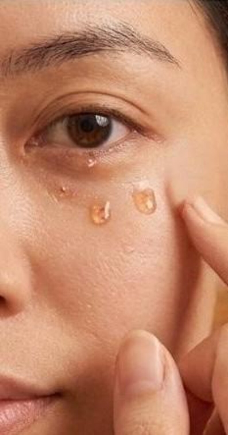 May include: Close-up of a person's eye and face with three drops of a clear, amber-colored liquid applied under the eye. A finger gently touches the skin near the eye. The skin is light-toned.
