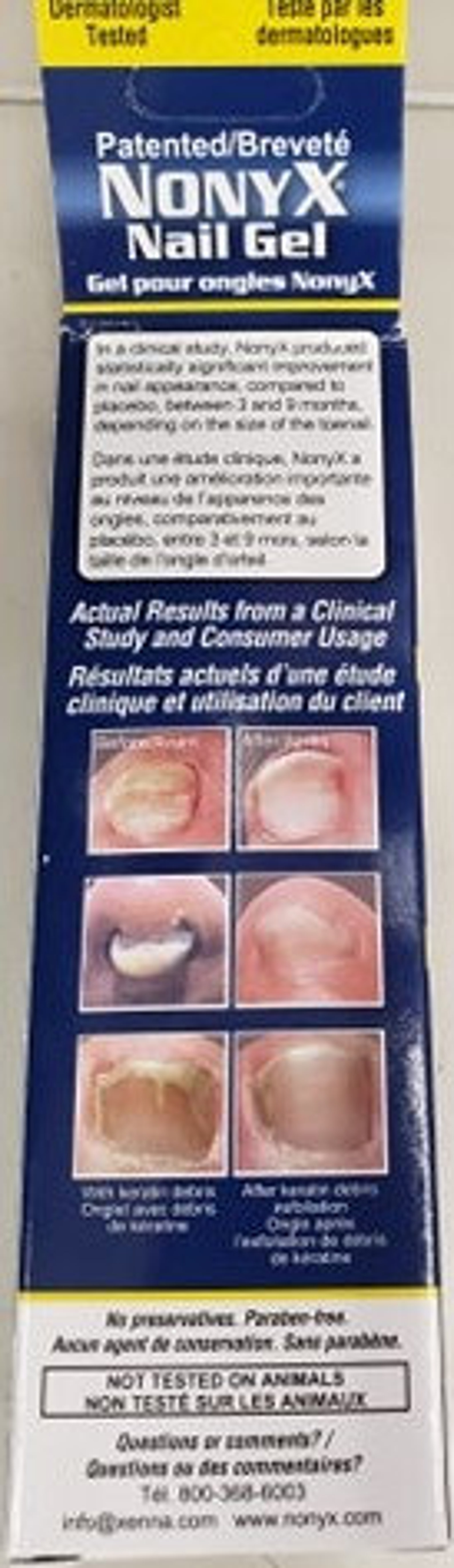 Nonyx Nail Gel Fungal Nail Clarifying Gel 120 gram Etsy