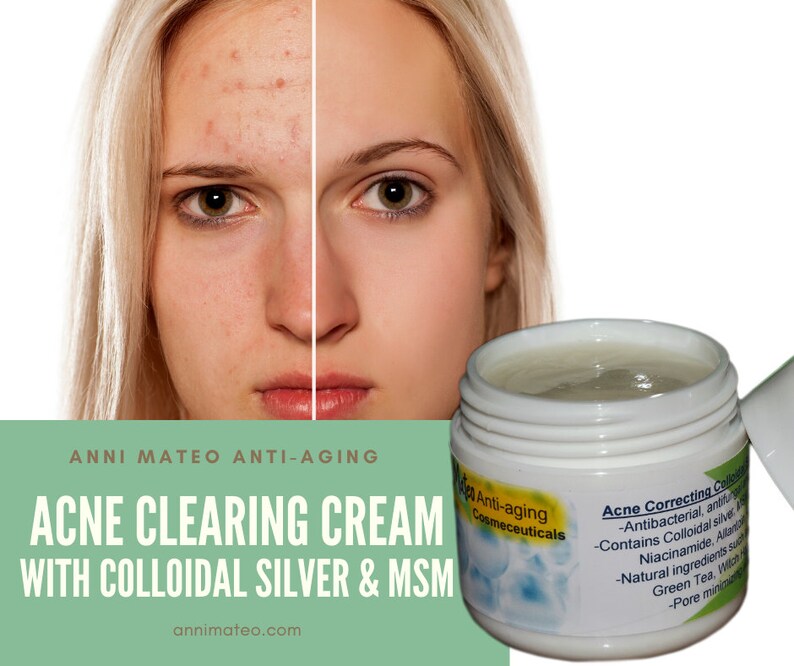 Colloidal Silver MSM Cream for Teenage Acne Spots Pimples Etsy
