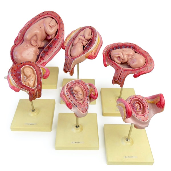 6 modèles didactiques de développement de l’embryon et du fœtus des années 1960-1970 - Cabinet de curiosités - Made in West Germany