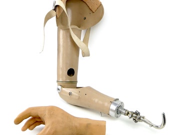 Prothèse de bras vintage articulée avec pince mécanique et main en silicone articulée - 2e moitié du XXe - Appareillage orthopédique