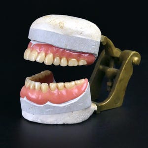 May include: A set of dentures in a plaster mold, mounted on a brass stand. The dentures are made of pink and white plastic and have a realistic appearance.