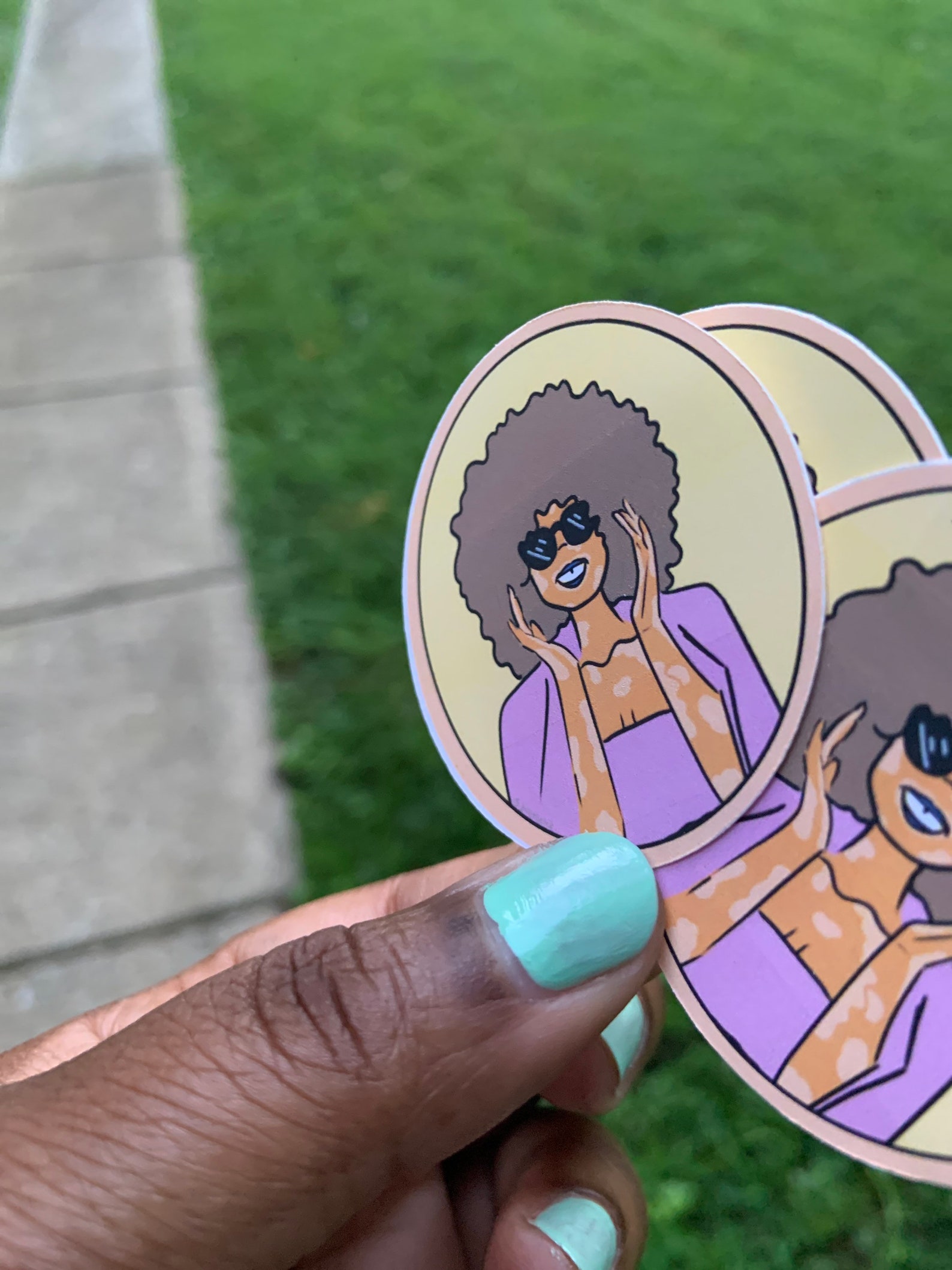 Fabulous Black Girl Model Vitiligo Representation Matters - Etsy