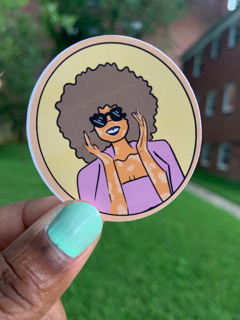 Fabulous Black Girl Model Vitiligo Representation Matters - Etsy