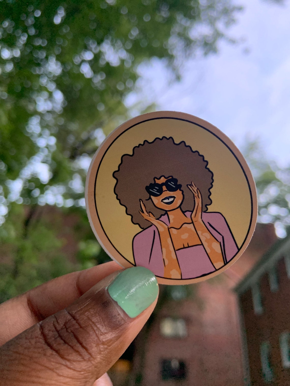 Fabulous Black Girl Model Vitiligo Representation Matters - Etsy