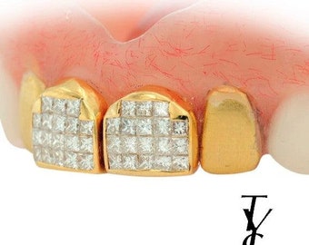 Four Individual Teeth Denture Grill