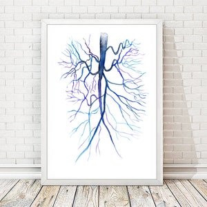 Aorta Angiogram Print, Medical Poster, Science Art, Abdominal Angiography, Arterial Blood Vessels Watercolor Painting, MRI Wall Decor A302