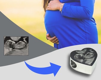 Ultrasound Baby Scan Photo Engraved Charm - Sonogram - 4D Scan - Fits Most Euro Style Bracelets & Bangles - Baby Shower Personalised Gift