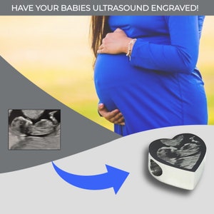 Ultrasound Baby Scan Photo Engraved Charm Sonogram 4D Scan Fits Most Euro Style Bracelets & Bangles Baby Shower Personalised Gift image 1