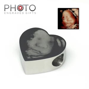 Ultrasound Baby Scan Photo Engraved Charm Sonogram 4D Scan Fits Most Euro Style Bracelets & Bangles Baby Shower Personalised Gift image 3