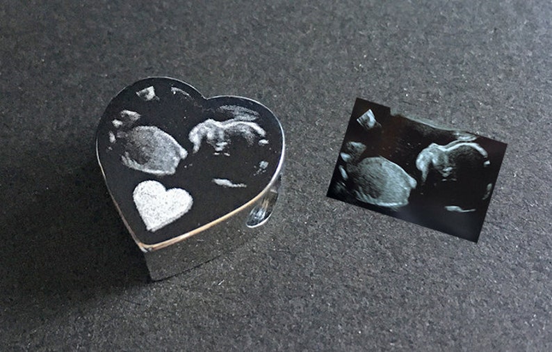 Ultrasound Baby Scan Photo Engraved Charm Sonogram 4D Scan Fits Most Euro Style Bracelets & Bangles Baby Shower Personalised Gift image 6