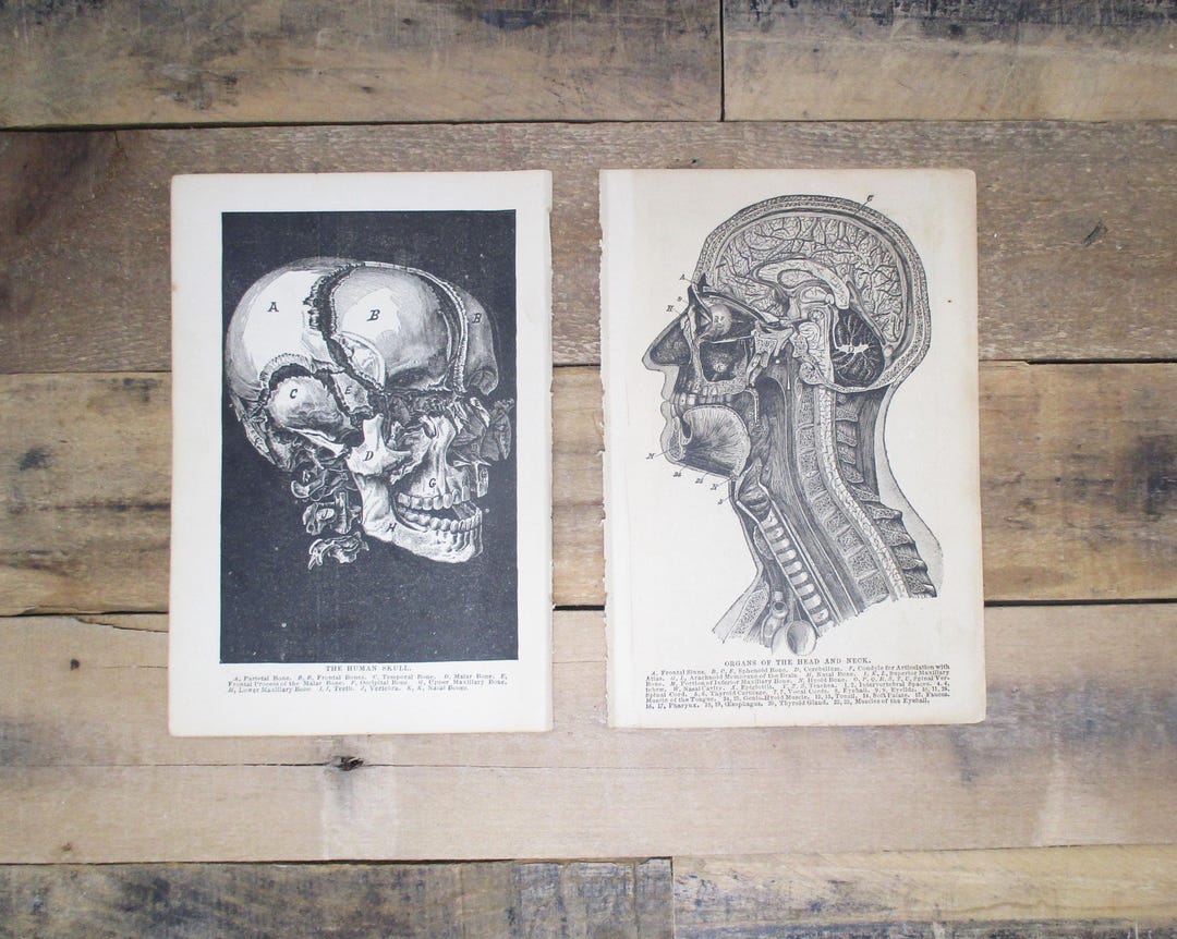 Antique Medical Anatomy Prints (set of 2) | Late 1800s Human Skull ...