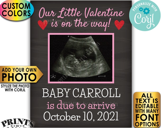 Ultrasound Valentine's Day Pregnancy Announcement, Our Little Valentine is On The Way, Custom PRINTABLE Sign <Edit Yourself w/Corjl>