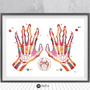 Rheumatoid Arthritis Print Autoimmune Inflamatory Disease Anatomy Watercolor Rheumathology Poster Medical Clinic Wall Decor Anatomy Art