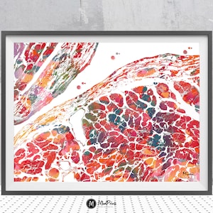 Hart ventrikel endocard anatomie afdrukken menselijk hart medische kunst aquarel hartoperatie cardiologie kliniek muur decor anatomie kunst cadeau