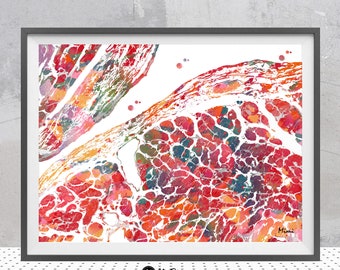 Heart Ventricle Endocardium Print | Cardiology Art | Cardio Clinic Decor | Cardiovascular Surgeon Gift