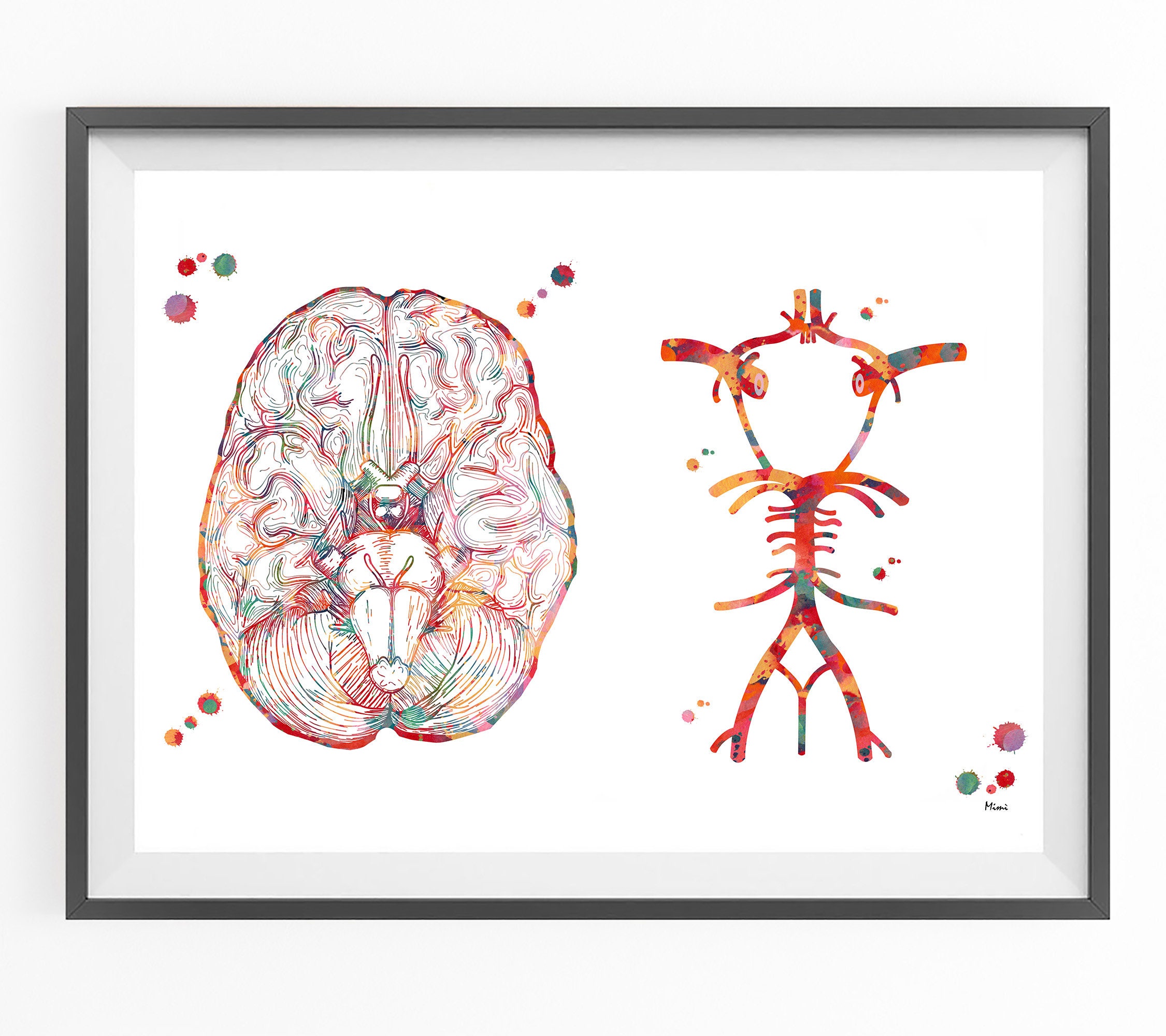 Circle Of Willis Diagram Blank