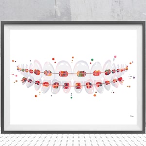 Zähne Klammern Aquarell Druck Zahnkunst Zähne Klammern Poster Kieferorthopädische Zahnheilkunde Illustration Zahnarzt Klinik Wanddekor