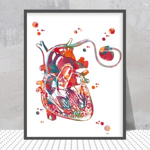 Rozrusznik serca Akwarela Wydruk Anatomia Sztuka Kardiologiczny Zewnętrzny rozrusznik serca Plakat Stymulator serca Sztuka medyczna Kardiologia Sztuka sercowo-naczyniowa
