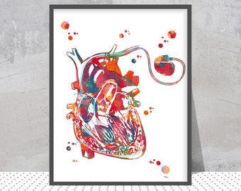 Herz Herzschrittmacher Aquarell Druck Anatomie Art Herz Herzschrittmacher Cardio Stimulator Poster Medizinische Kunst Kardiologie Cardiovaskules Art