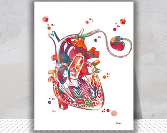 Herzschrittmacher Aquarell Druck Anatomie Kunst Herz externer Schrittmacher Cardio Stimulator Poster Medizinische Kunst Kardiologie Herz-Kreislauf-Kunst