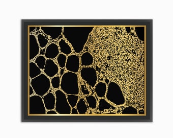 Thyroid Gland Gold Foil Print Thyroid Tissue Gold Foil Poster Endocrine System Anatomy Print Statement Gift For Endocrinologist