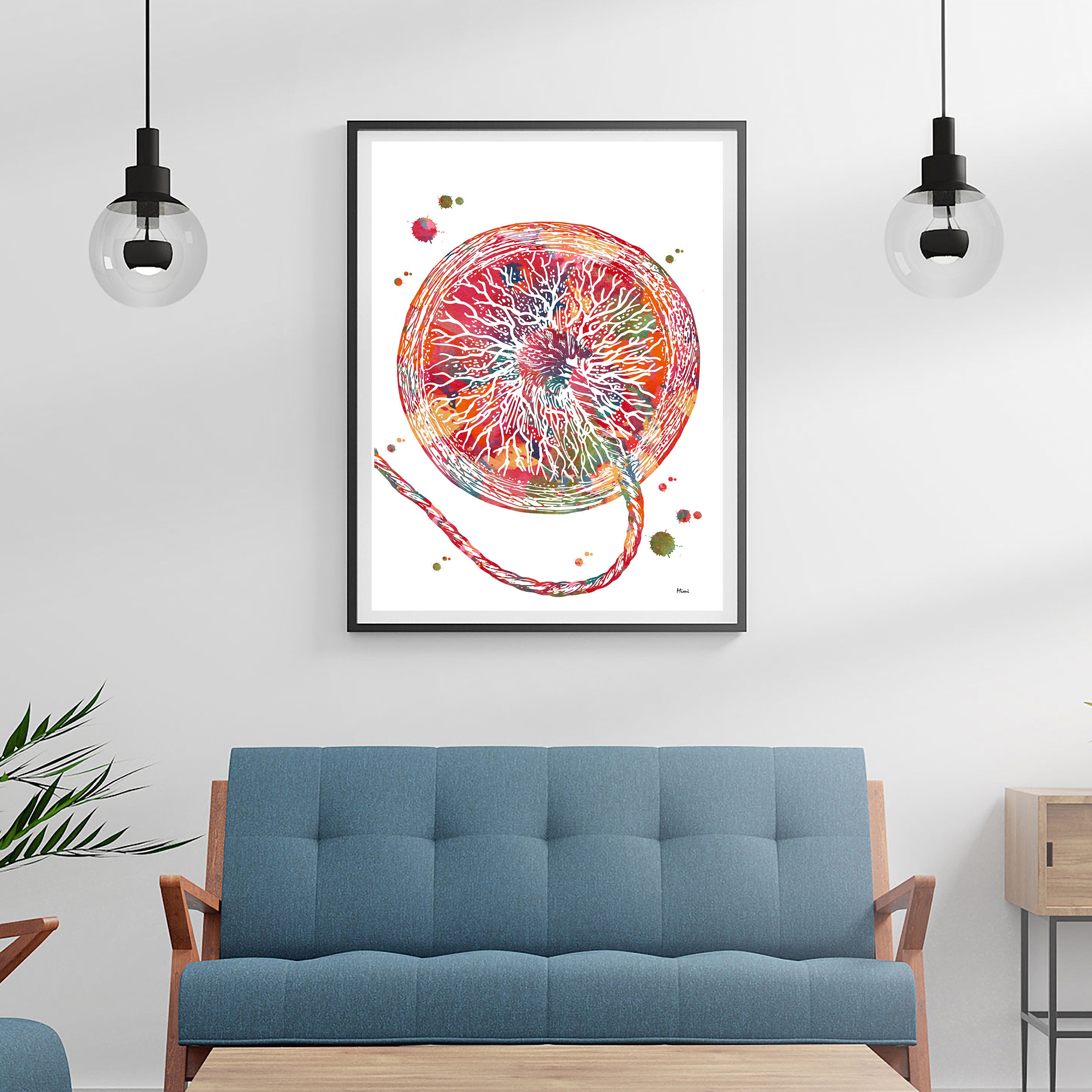 Placenta OB-GYN Print | Anatomy Art | Fertility Clinic Decor - Etsy