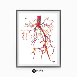 Aorta Angiogram Print Aorta Angiography Watercolor Angiology Painting Abstract Anatomy Print Medical Art Cardiovascular Radiology Print image 5