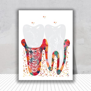Tooth Implant Watercolor Print Dentistry Poster Dental Print Molar Implant Painting Dental Surgery Illustration Dentist Clinic Decor