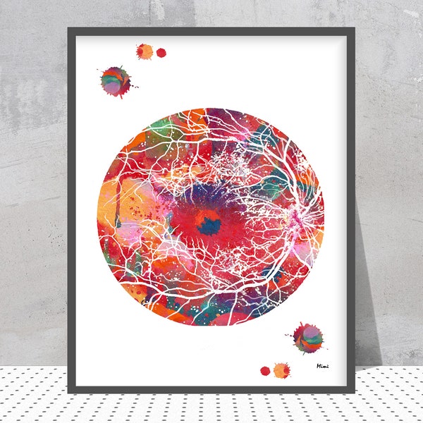 Retina Art Print Eye Anatomy Poster Optometry Illustration Optic Disc and Retinal Blood Vessels Ophthalmology Clinic Decor Retina Print