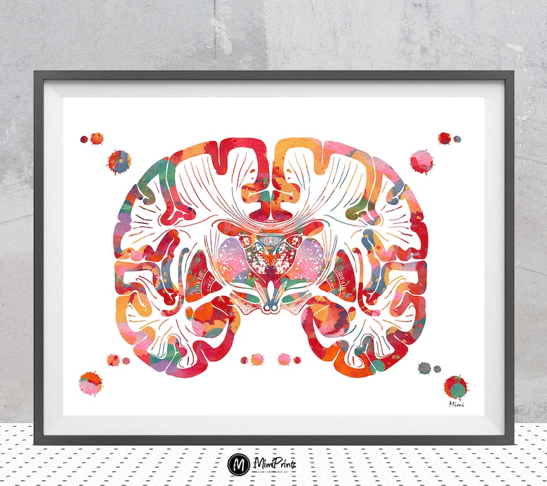 Brain Coronal Section Watercolor Print | Neurology Art | Neurologist ...