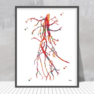 Angiography Watercolor Femoral Artery Occlusion Abstract Anatomy Print Angiogram Poster Angiology Print Radiology Vascular Surgeon Art Gift