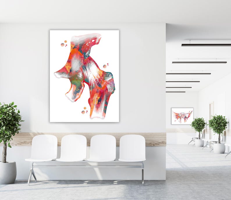 May include: A large, rectangular watercolor print of a hip joint, showcasing a vibrant mix of red, orange, green, and white hues. The artwork is displayed on a white wall in a waiting room setting, with white chairs and a plant.