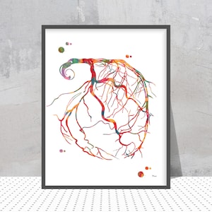 Heart Vascularization Print Coronary Angiogram Poster Cardiology Art Cardiologist Gift Heart Surgery Medical Art