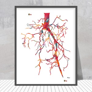 Aorta Angiogram Print Aorta Angiography Watercolor Angiology Painting Abstract Anatomy Print Medical Art Cardiovascular Radiology Print image 1