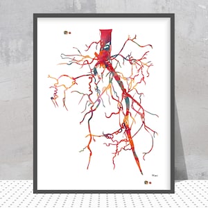 Aorta Angiogram Print Aorta Angiography Watercolor Angiology Painting Abstract Anatomy Print Medical Art Cardiovascular Radiology Print image 1