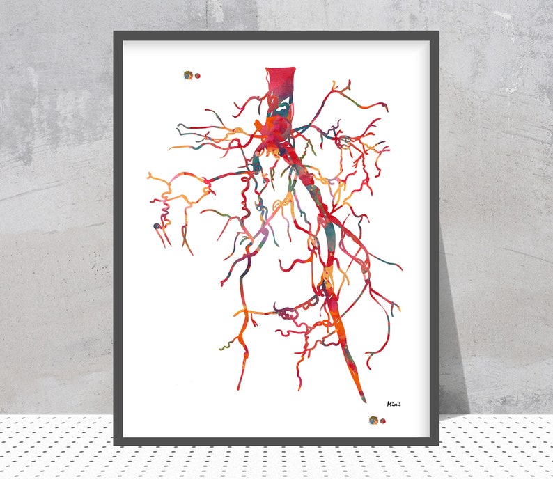 Aorta Angiogram Print Aorta Angiography Watercolor Angiology Painting Abstract Anatomy Print Medical Art Cardiovascular Radiology Print image 1