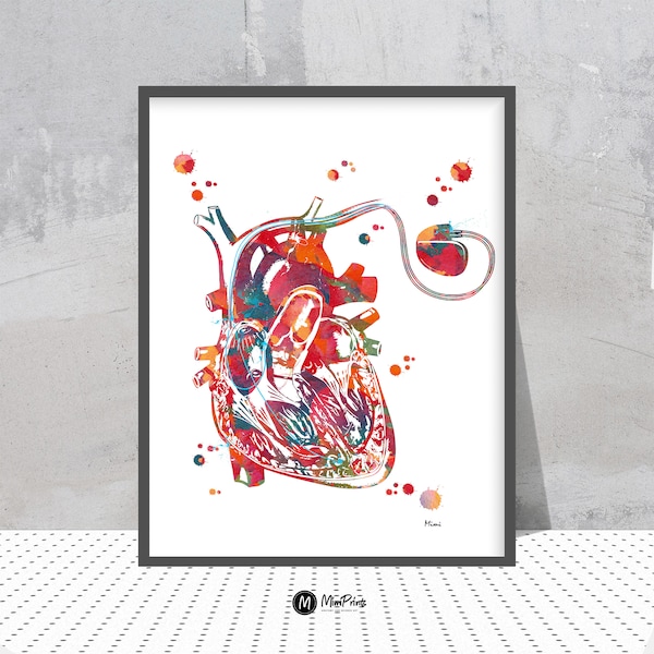 Heart Pacemaker Watercolor Print Anatomy Art Cardiac External Pacemaker Cardio Stimulator Poster Medical Art Cardiology Cardiovascular Art