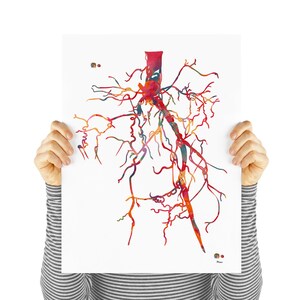 Aorta Angiogram Print Aorta Angiography Watercolor Angiology Painting Abstract Anatomy Print Medical Art Cardiovascular Radiology Print image 2