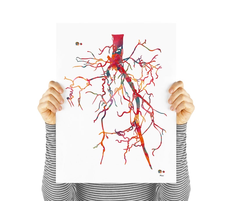 Aorta Angiogram Print Aorta Angiography Watercolor Angiology Painting Abstract Anatomy Print Medical Art Cardiovascular Radiology Print image 2