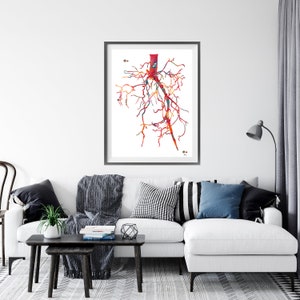 Aorta Angiogram Print Aorta Angiography Watercolor Angiology Painting Abstract Anatomy Print Medical Art Cardiovascular Radiology Print image 7